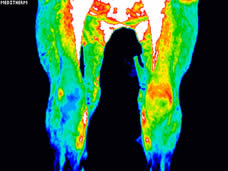 Digital Infrared Thermal Imagin ing (DITI)